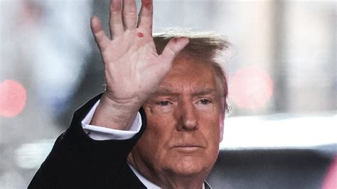 Donald Trump S Camp Reveals Reason For Mysterious Marks On His Hands