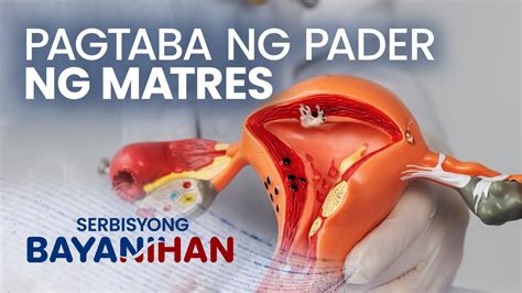 Ano Ang Adenomyosis O Pagtaba Ng Pader Ng Matres Youtube