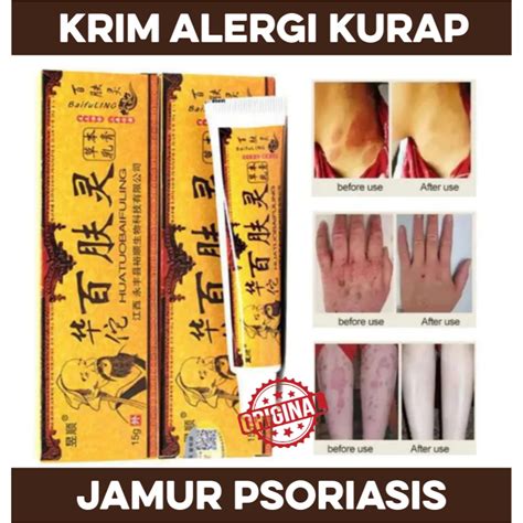 Jual Salep Cream Jamur Kurap Alergi Kulit Psoriasis Eksim Krim