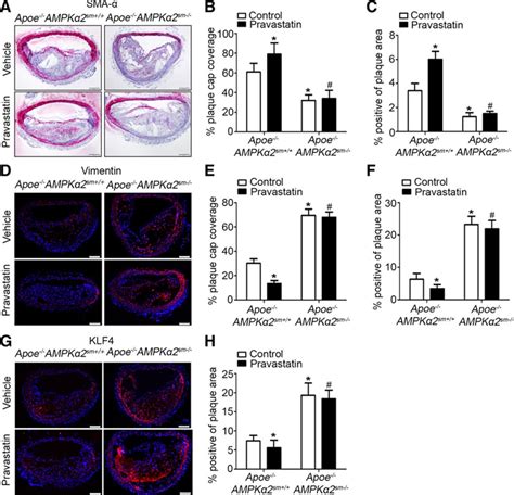 Activated Protein Kinase Alpha Deletion Induces Vsmc Phenotypic