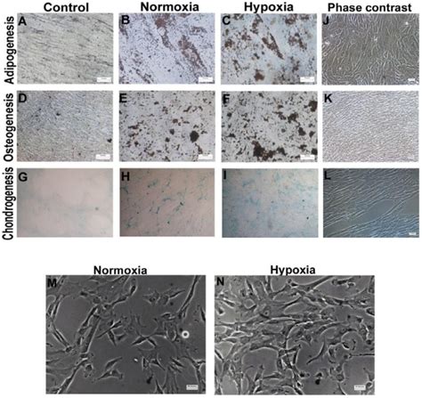 Morphology And Multilineage Differentiation Potential Of Wj Mscs