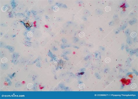 Muestra Histológica Células Epiteliales Escamosas Bajo Microscopio