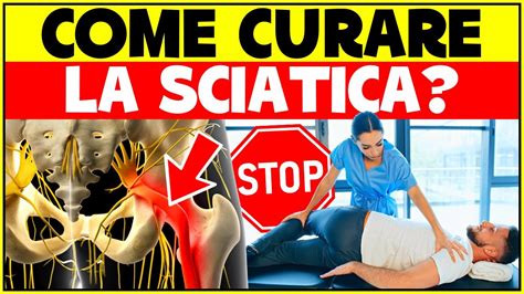 Come Curare La Sciatica Velocemente Nervo Sciatico Infiammato Come