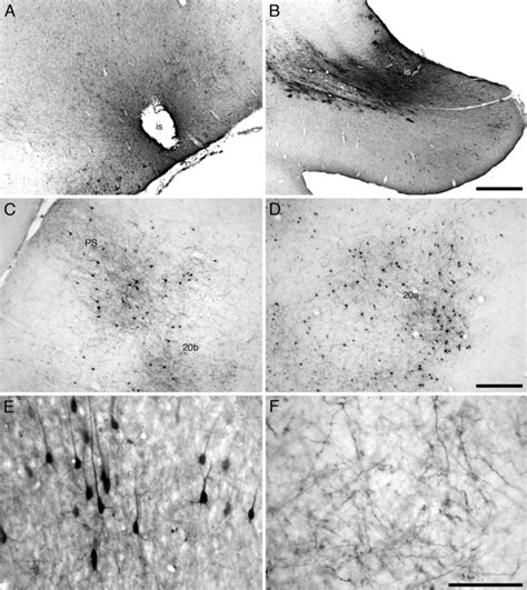 Photomicrographs Showing Examples Of Injection Sites A B And