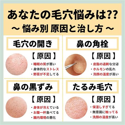 【知らないと損】99が知らない毛穴の原因と治し方リスト 毛穴ケア💐コーくん先生が投稿したフォトブック Lemon8