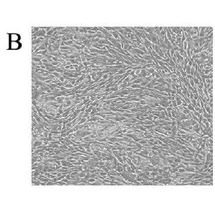 Morphological Changes In Peritoneal Mesothelial Cells Pmcs After