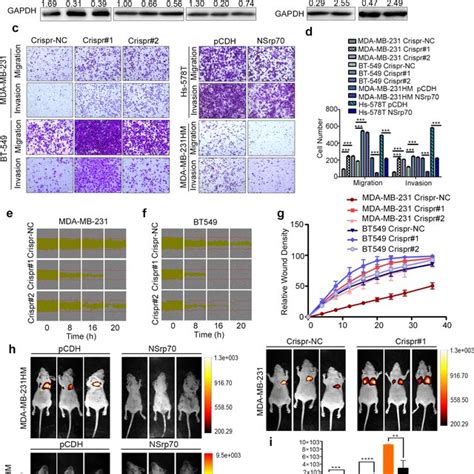 Loss Of Nsrp Promotes Breast Cancer Cell Migration And Metastasis In