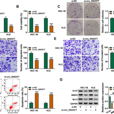 Effects Of Circ0002577 Inhibition On Proliferation Migration Download Scientific Diagram