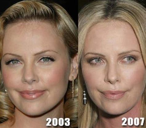 Charlize Theron before and after plastic surgery (32) – Celebrity ...