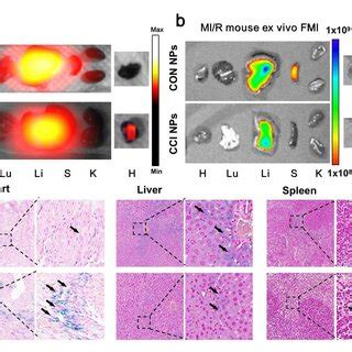 Ex Vivo Imaging And Prussian Blue Staining Of The MI R Mouse Model The