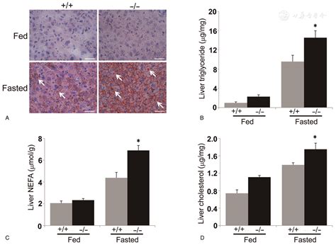 Rubicon Deficiency Exacerbates Fasting Induced Hepatic Steatosis