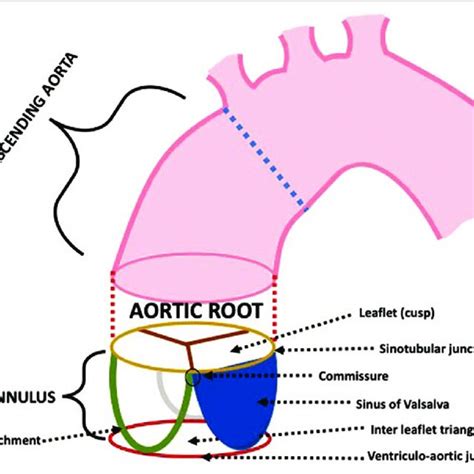 Representation Of The Aortic Root And Its Components The Most Widely