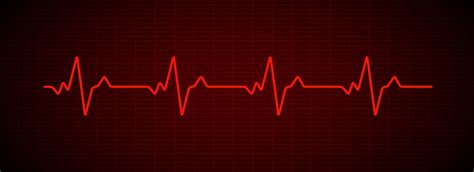 What is Sinus Arrhythmia? Symptoms, Causes & Treatment