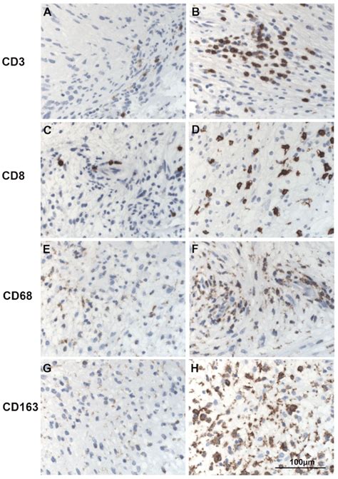 Examples Of The Immunohistochemical Expression Differences Of