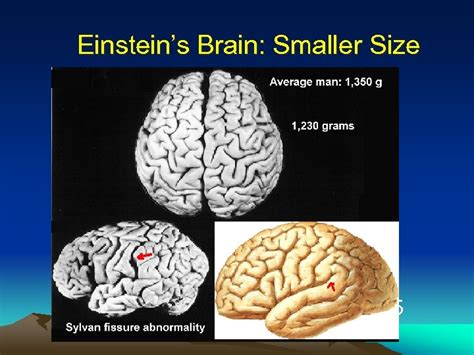 Einstein s Brain 1879 -1955 Einstein s Brain