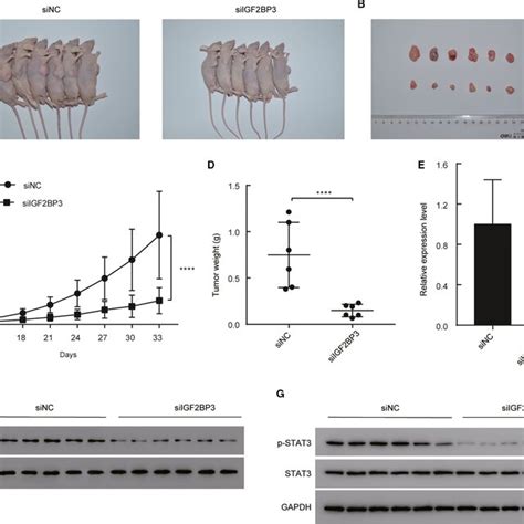 Overexpression Of Igf2bp3 Promoted The Tumorigenesis Of Bladder Cancer Download Scientific