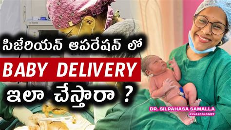 Cesarean operation ఎల చసతర Baby డలవర ఎల అవతద Cesarean