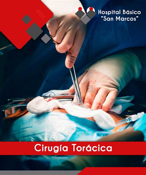 Cirug A Tor Cica Hospital B Sico San Marcos