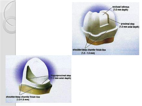 Advances in All Ceramic Restorations | PPT