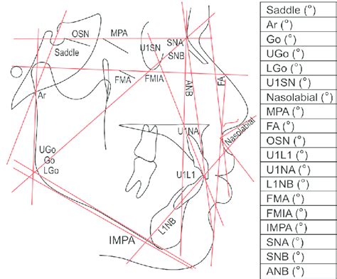 Lateral cephalometric tracing with angular measurements | Download Scientific Diagram