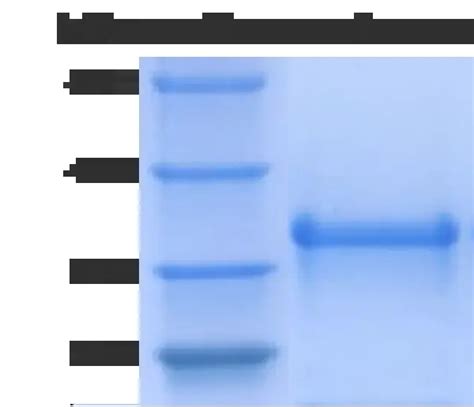 Bluegene Recombinant Proteins Interleukin Proteins