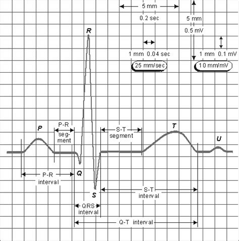 The Standard Ecg Paper With Time Intervals And Segments Download