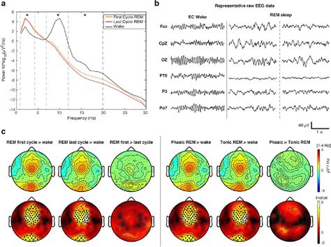 Table From Human Rapid Eye Movement Sleep Shows Local Increases In