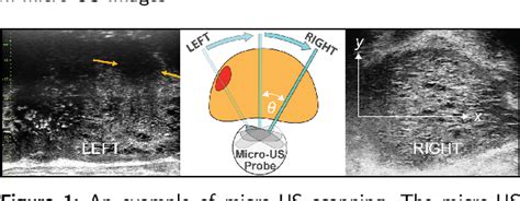 Figure From Microsegnet A Deep Learning Approach For Prostate