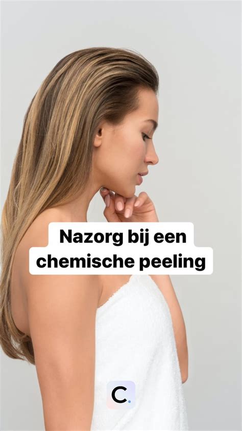 Chemische Peeling Lees Hier Wat Je Moet Weten Artofit