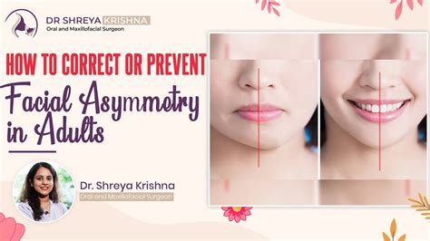 How To Get A Symmetrical Face L Fix Asymmetrical Face L Asymmetrical Face Causes L Dr Shreya