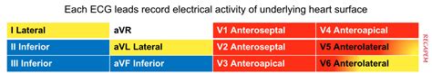 Acute Myocardial Infarction A Shifting Paradigm Recapem