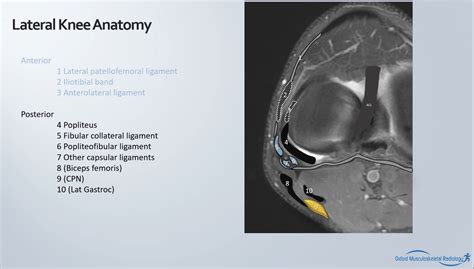 Benoît Rizk On Twitter Fibular Collateral Ligament Is 1 Of The 3 Important Structures To