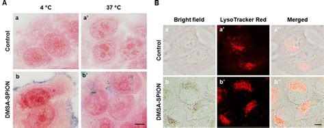 Internalization Mechanism And Accumulation Of Dmsa Spion Inside Cells