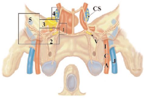 Figure 1 From Expanded Endonasal Approach Fully Endoscopic Completely