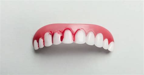 Gingivectomy: Procedure, Risks and Benefits - Zenit Dent