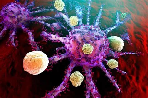 Síndrome de lisis tumoral en cáncer de próstata