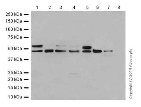 Glucose Transporter Glut3gtr14重组抗体 Epr10508n Glucose Transporter