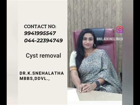 Cyst Removal Dr Snehalatha East Tambaram YouTube