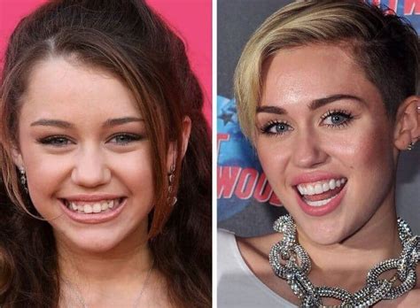 Celebrity Teeth Six Best Dental Before and After Makeovers