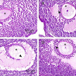 Photomicrographs Of Pas Stained Ovarian Sections A Control