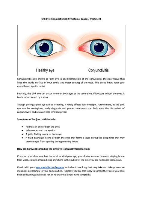 Pink Eye Conjunctivitis Symptoms Causes Treatment By