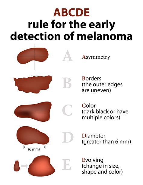 Skin Cancer | Advanced Dermatology