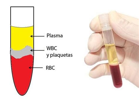 Qu Diferencia Suero Y Plasma Sangu Neo Curiosoando