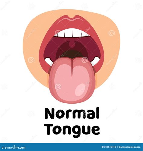 Normal Tongue Vector Illustration Stock Vector Illustration Of Medicine Illness 316510416