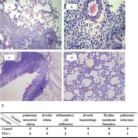 Pulmonary Histological Evaluation And Pathological Scores The Lung Download Scientific Diagram