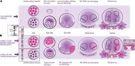 Frontiers Determining The Cause Of Intrauterine Fetal Death In