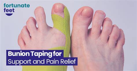 Bunion Taping For Support And Pain Relief Fortunate Feet