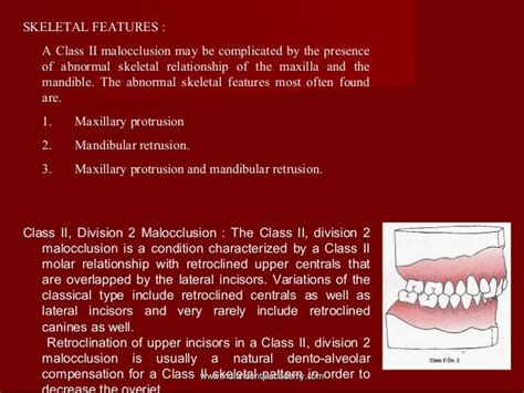 Skeletal Malocclusion