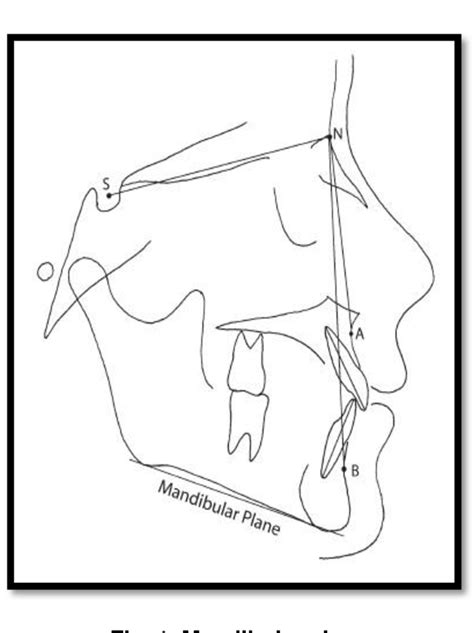 Figure 1 From Relationship Between Dental Arch Width And Vertical