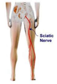 Sciatic Nerve: Anatomy, Branches, Sciatica, Related Muscles